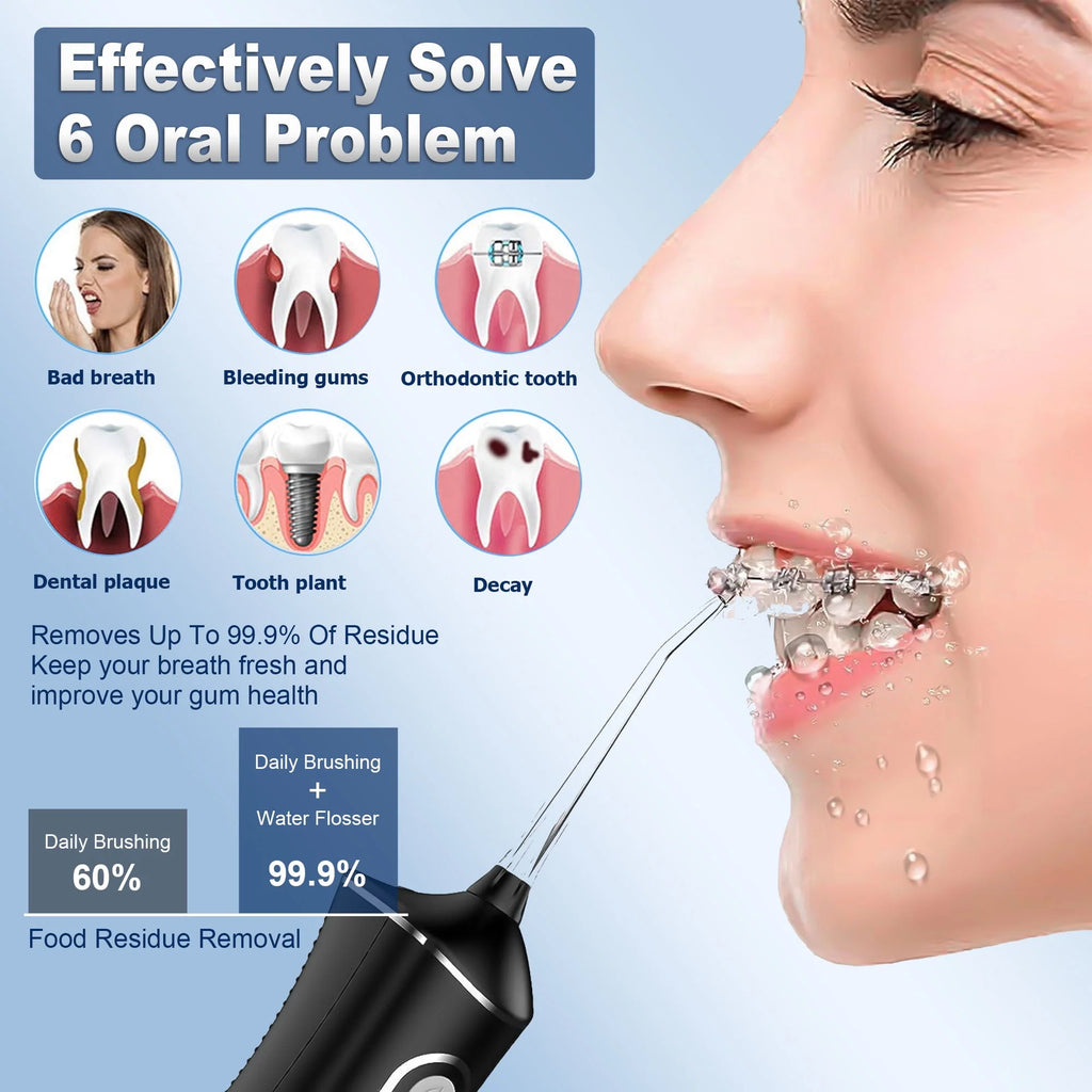 Cordless Water Flosser 4 Modes 300ml IPX7 B477
